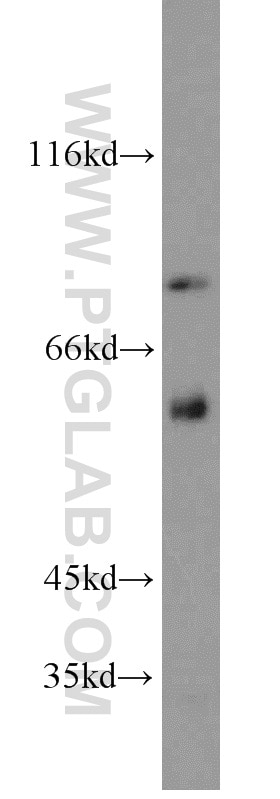 Western Blot (WB) analysis of HepG2 cells using PCIF1 Polyclonal antibody (16082-1-AP)