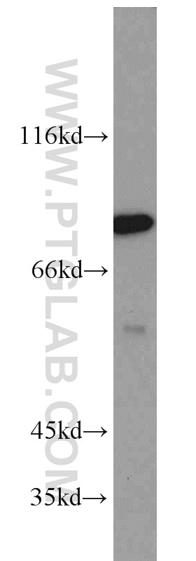 Western Blot (WB) analysis of Jurkat cells using PCIF1 Polyclonal antibody (16082-1-AP)