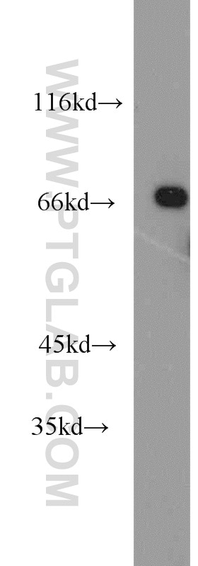 Western Blot (WB) analysis of HepG2 cells using PCK1 Polyclonal antibody (16754-1-AP)