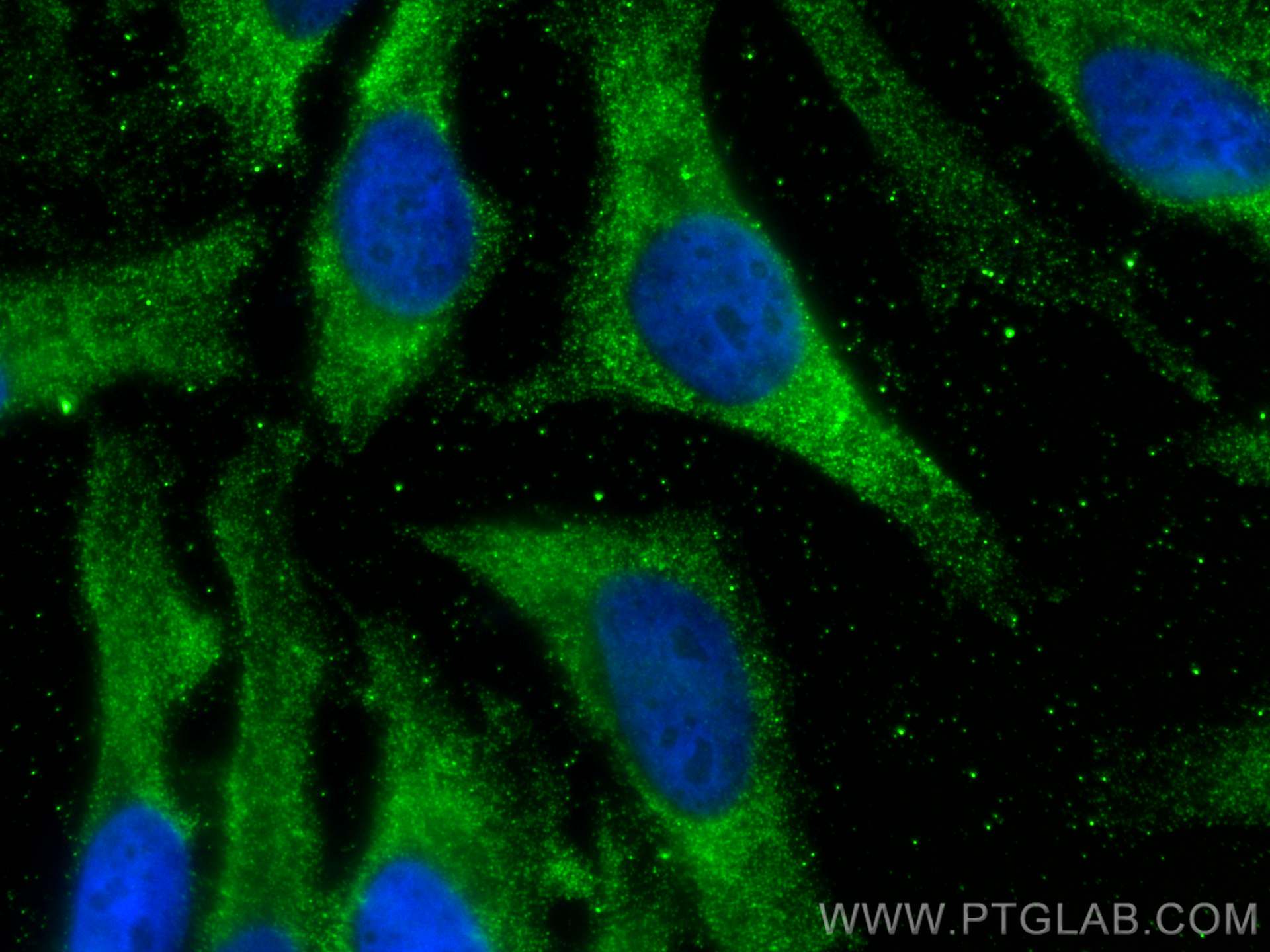 Immunofluorescence (IF) / fluorescent staining of HeLa cells using PCK1 Monoclonal antibody (66862-1-Ig)