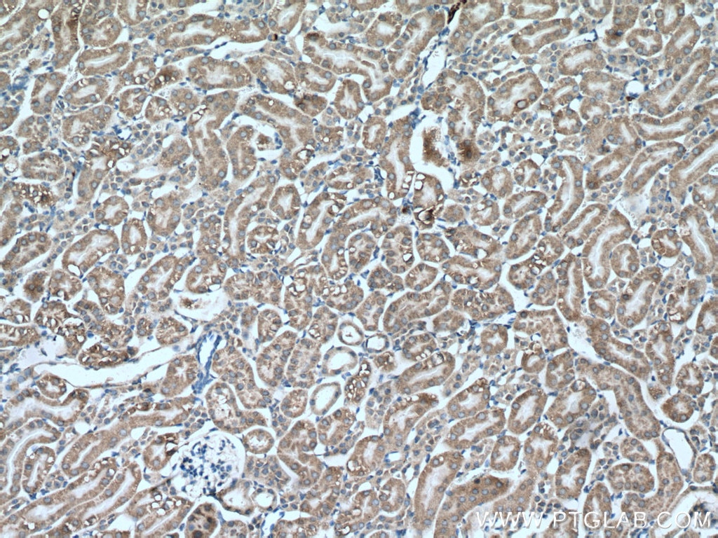 IHC staining of mouse kidney using 66862-1-Ig