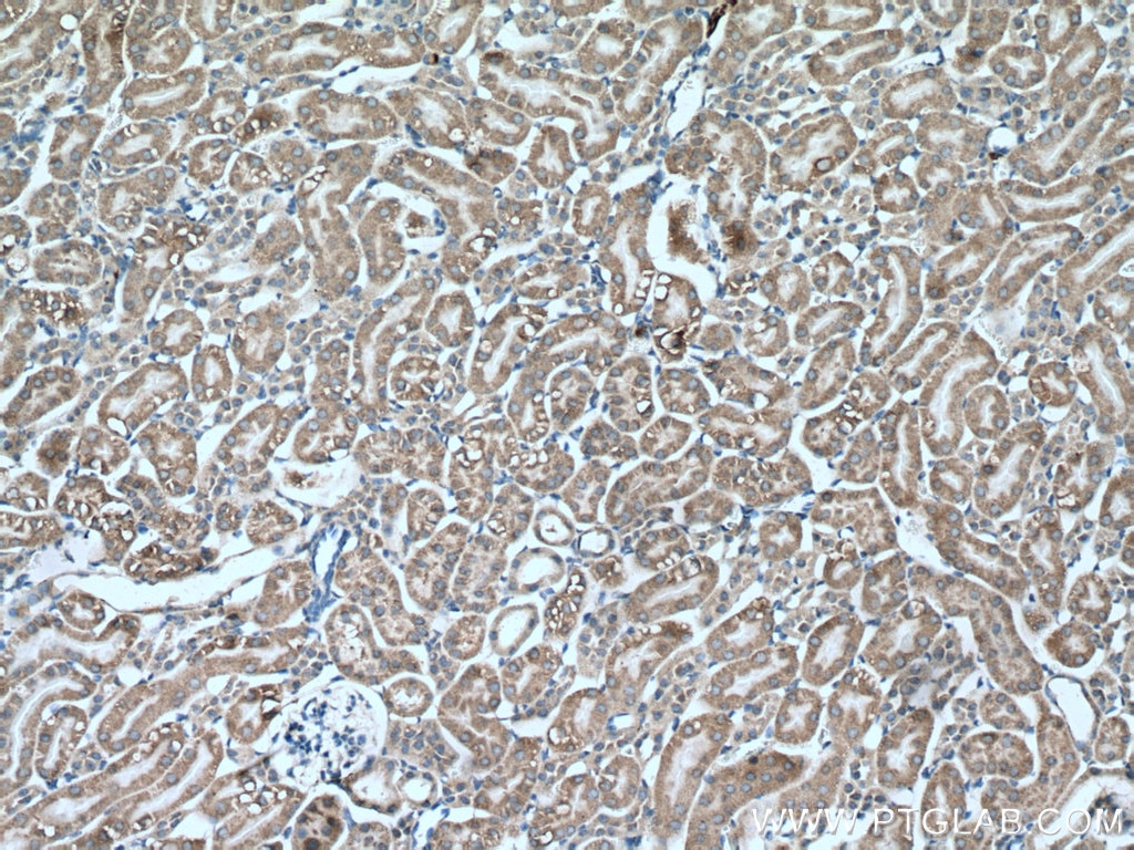 Immunohistochemistry (IHC) staining of mouse kidney tissue using PCK1 Monoclonal antibody (66862-1-Ig)