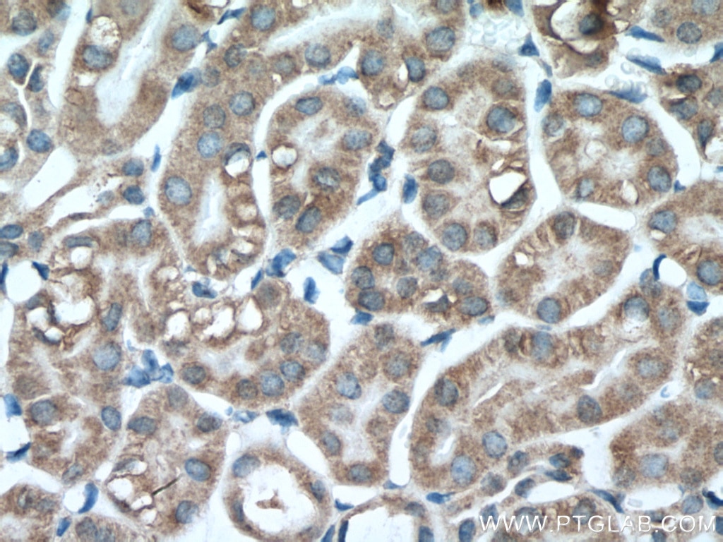 Immunohistochemistry (IHC) staining of mouse kidney tissue using PCK1 Monoclonal antibody (66862-1-Ig)