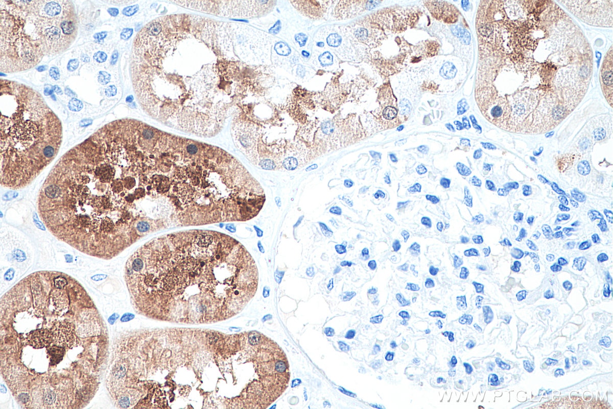 Immunohistochemistry (IHC) staining of human kidney tissue using PCK1 Monoclonal antibody (66862-1-Ig)