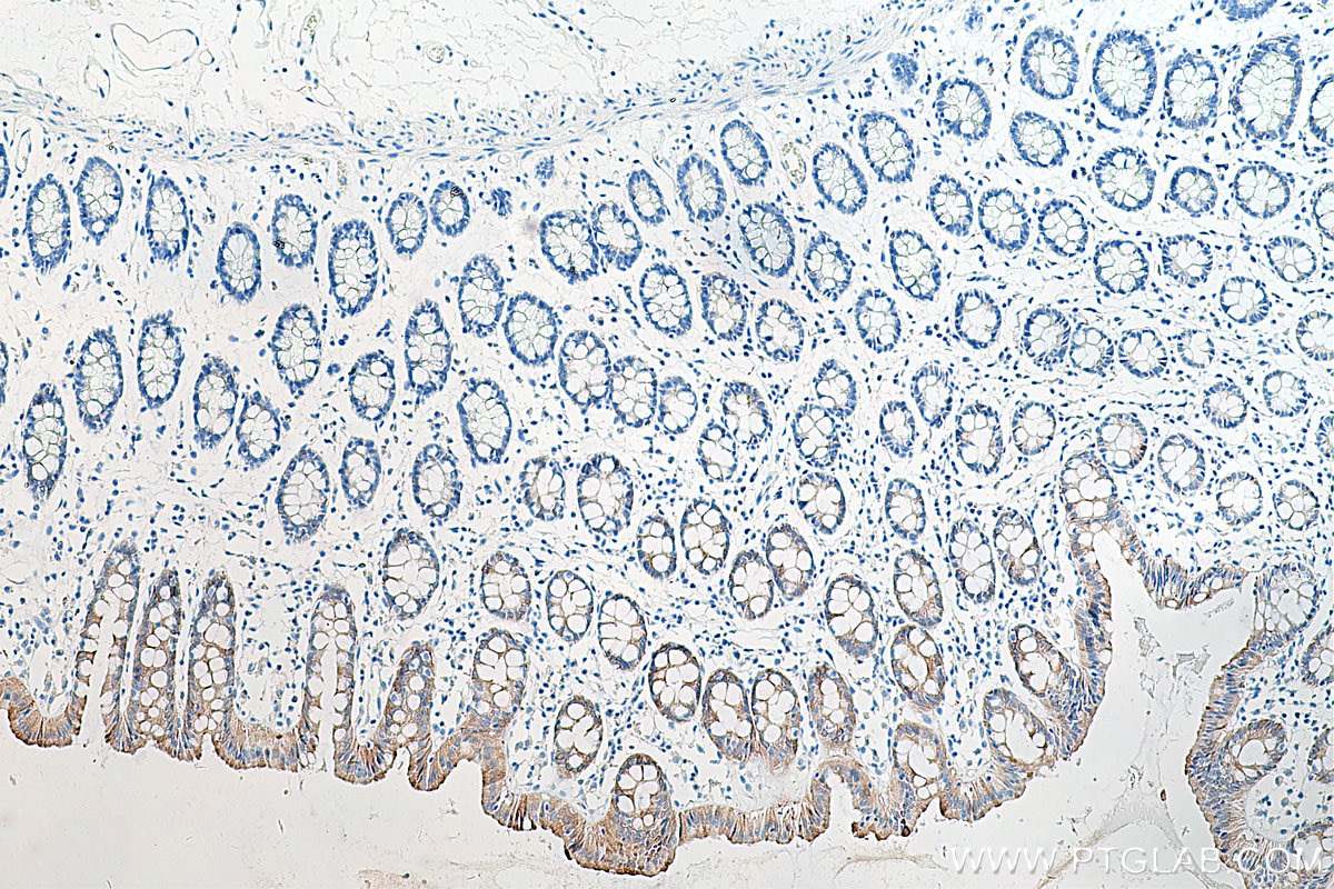 IHC staining of human colon using 66862-1-Ig