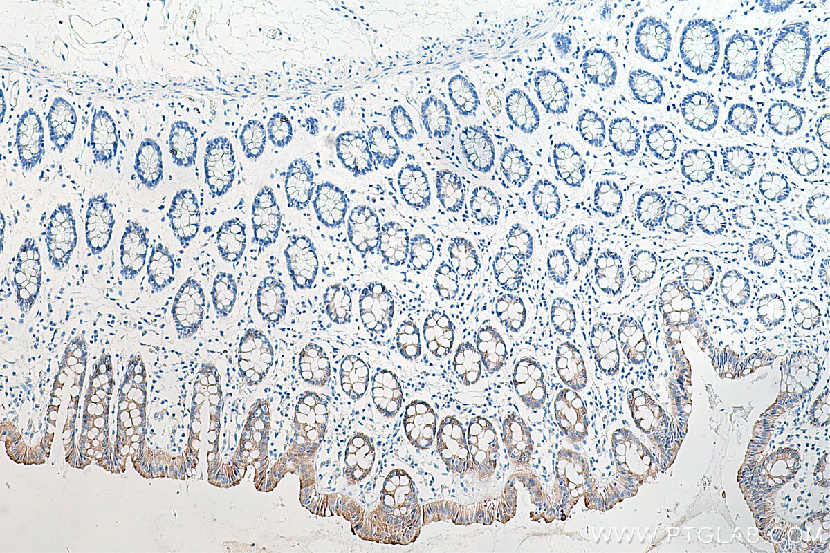 Immunohistochemistry (IHC) staining of human colon tissue using PCK1 Monoclonal antibody (66862-1-Ig)