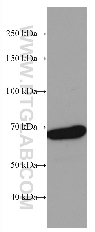 PCK1