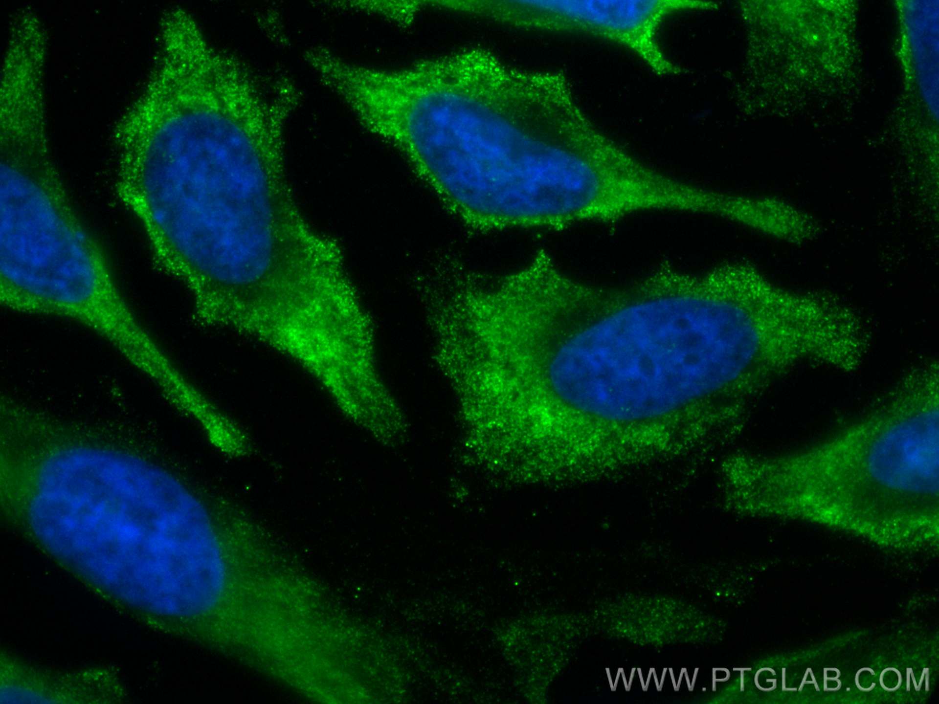 Immunofluorescence (IF) / fluorescent staining of HeLa cells using CoraLite® Plus 488-conjugated PCK1 Monoclonal anti (CL488-66862)