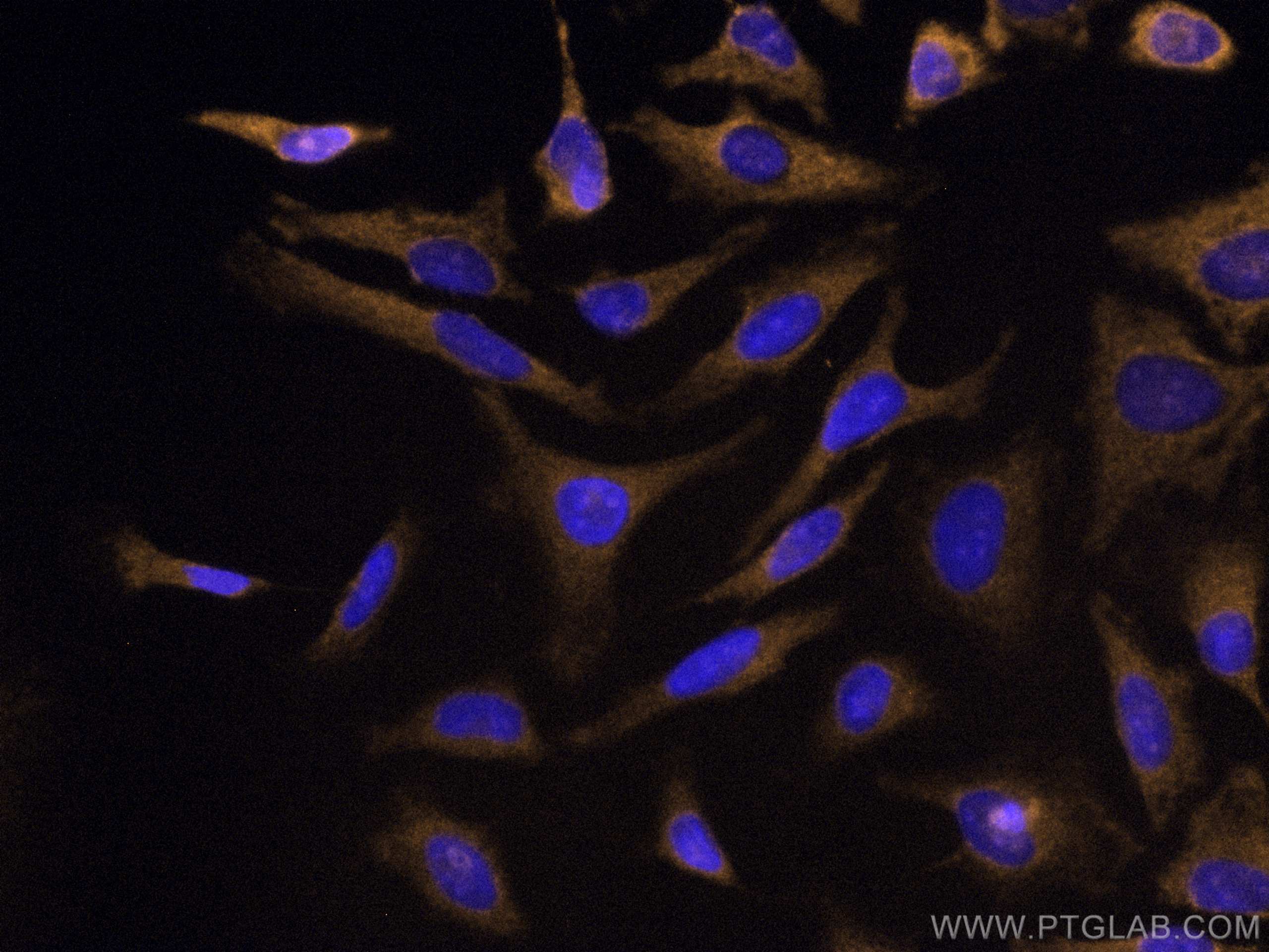 Immunofluorescence (IF) / fluorescent staining of HeLa cells using CoraLite®555-conjugated PCK1 Monoclonal antibody (CL555-66862)