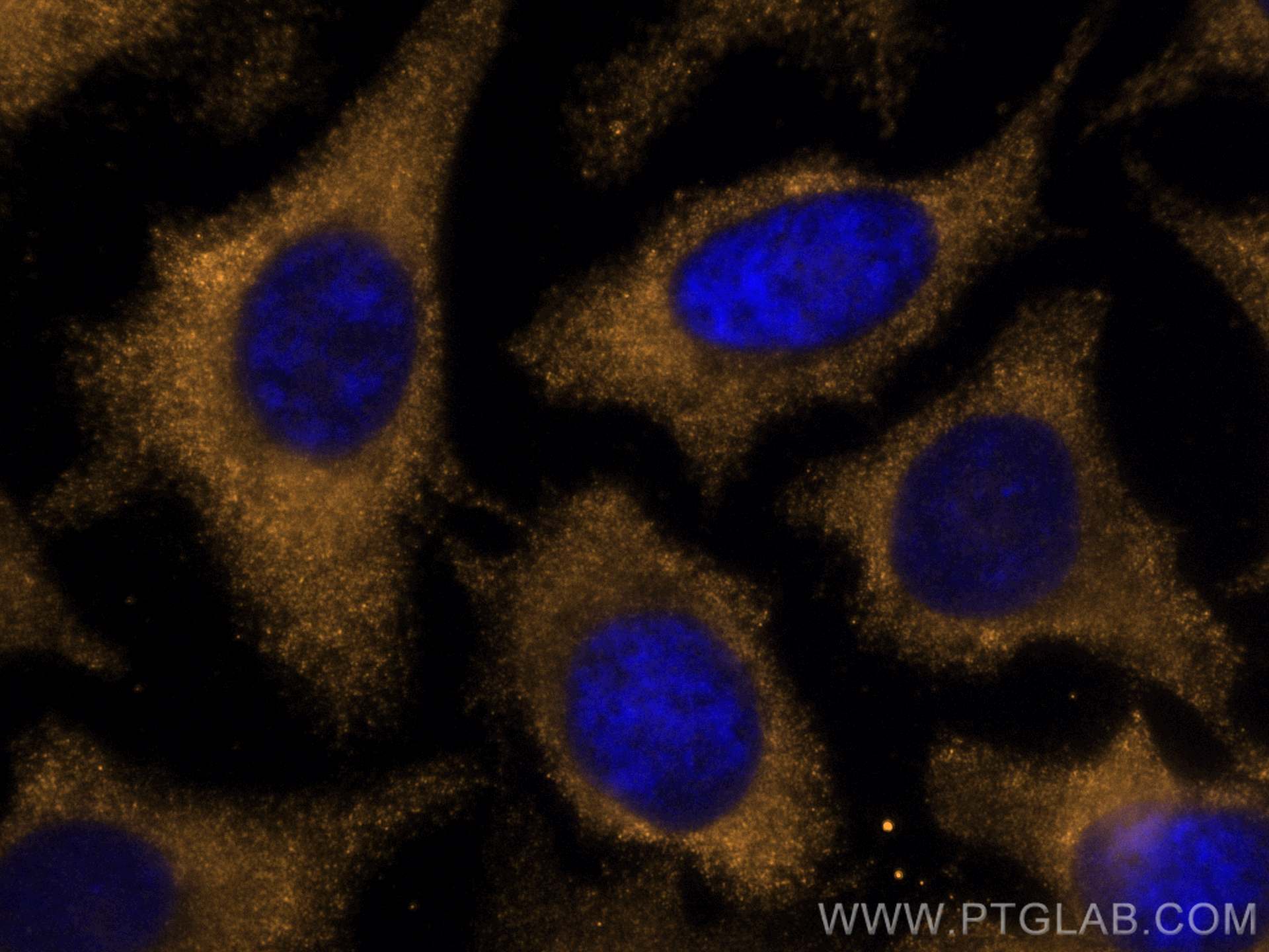 Immunofluorescence (IF) / fluorescent staining of HeLa cells using CoraLite®555-conjugated PCK1 Monoclonal antibody (CL555-66862)