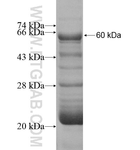 PCK1 Fusion Protein Ag10261 Proteintech