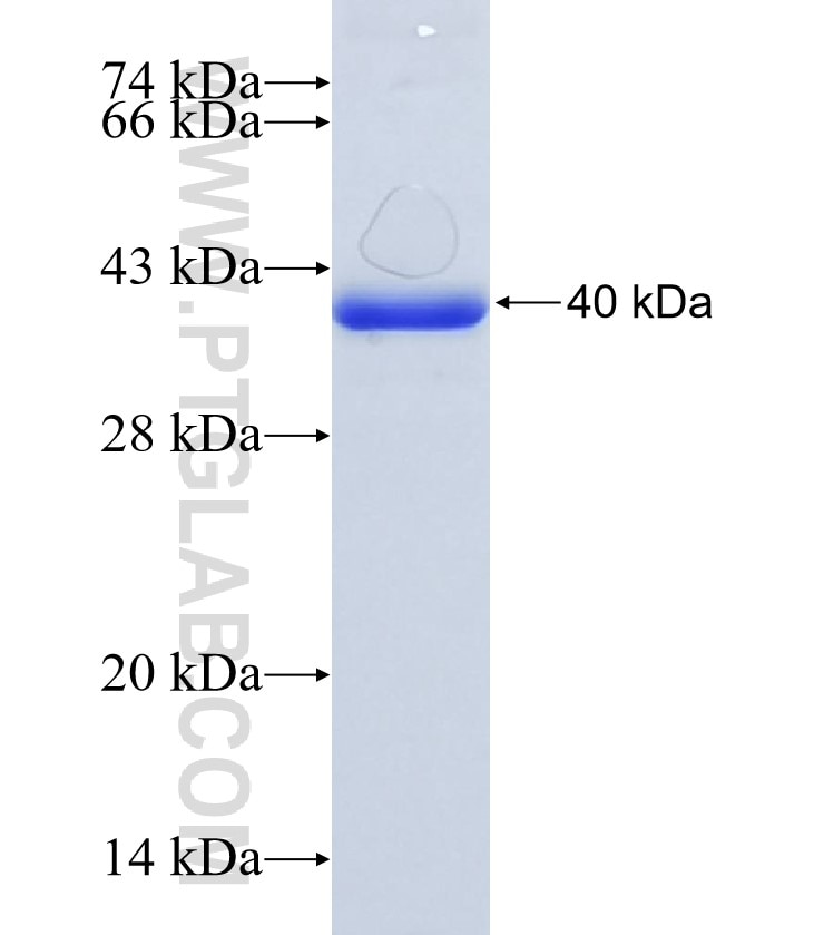 PCK1 fusion protein Ag9720 SDS-PAGE