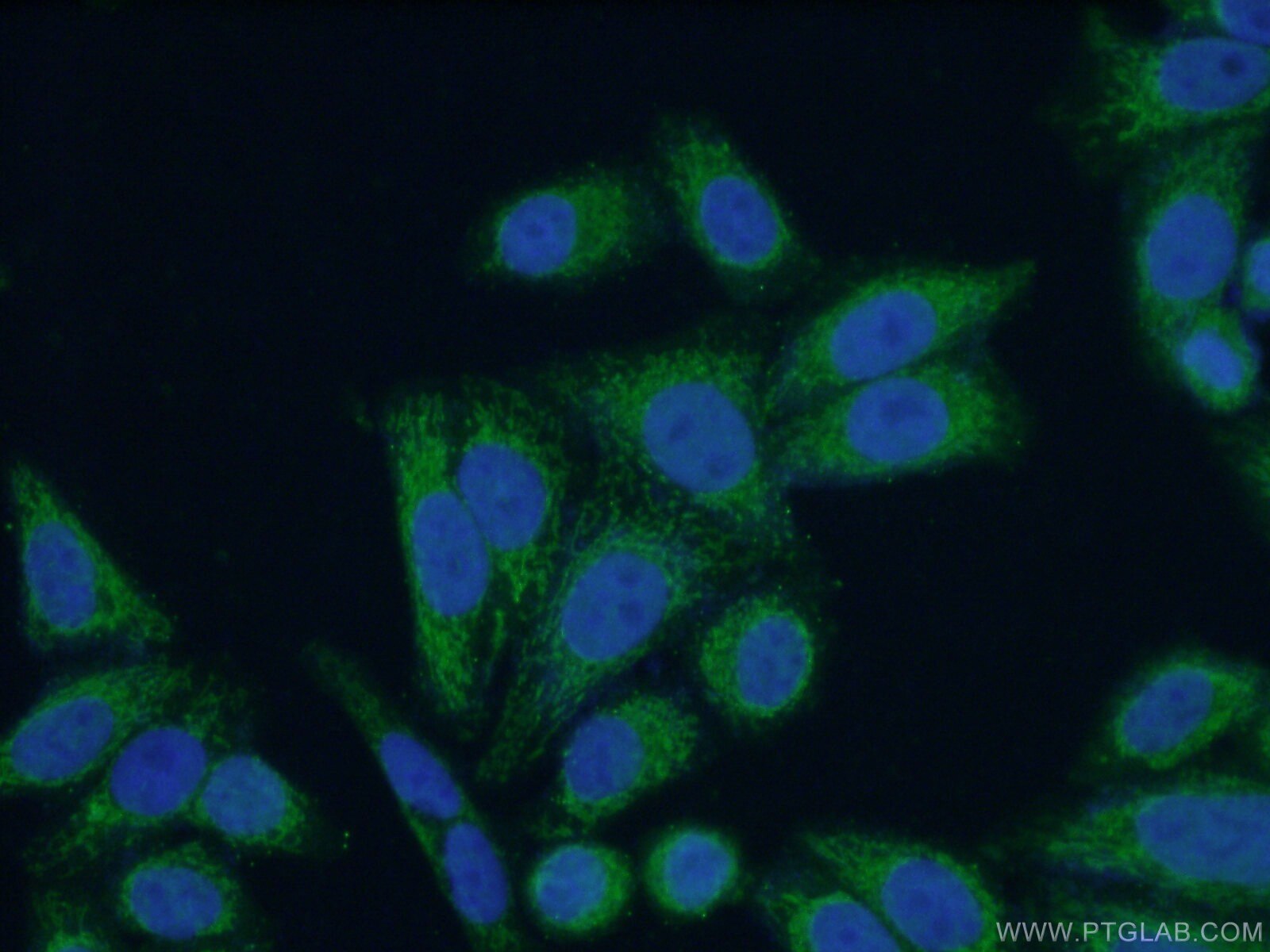 IF Staining of HepG2 using 14892-1-AP