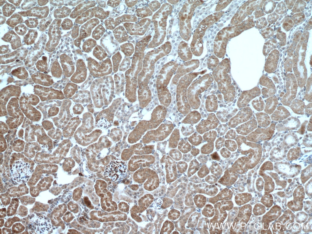 Immunohistochemistry (IHC) staining of mouse kidney tissue using PCK2 Polyclonal antibody (14892-1-AP)