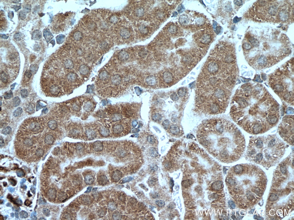 Immunohistochemistry (IHC) staining of mouse kidney tissue using PCK2 Polyclonal antibody (14892-1-AP)
