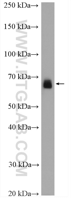 Western Blot (WB) analysis of rat brain tissue using PCK2 Polyclonal antibody (14892-1-AP)