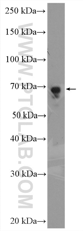 Western Blot (WB) analysis of mouse liver tissue using PCK2 Polyclonal antibody (14892-1-AP)