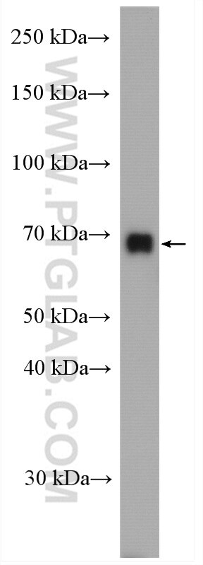 Western Blot (WB) analysis of mouse brain tissue using PCK2 Polyclonal antibody (14892-1-AP)