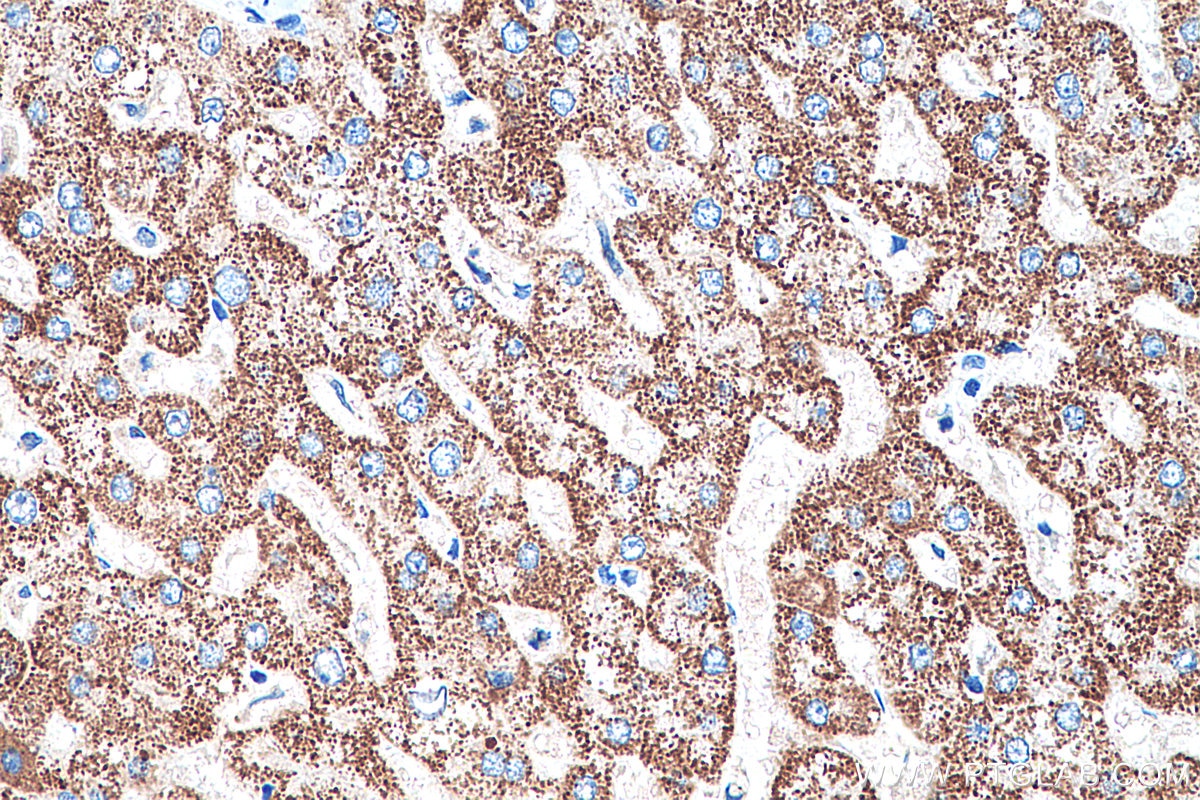 Immunohistochemistry (IHC) staining of human liver tissue using PCK2 Monoclonal antibody (67676-1-Ig)