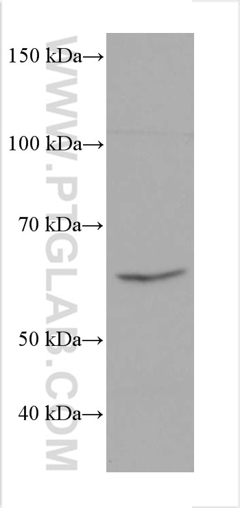 Western Blot (WB) analysis of rabbit liver tissue using PCK2 Monoclonal antibody (67676-1-Ig)