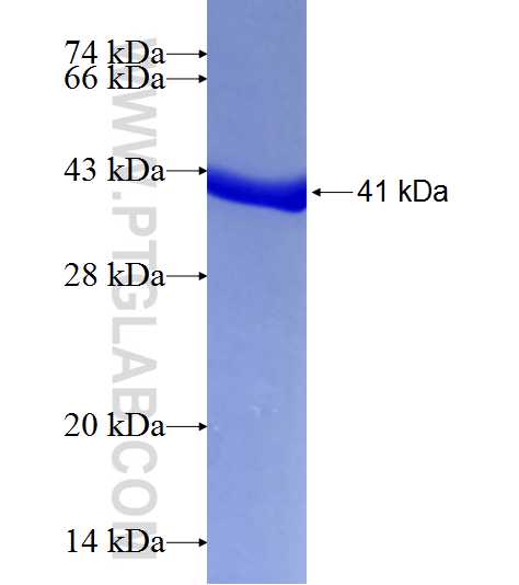 PCK2 fusion protein Ag7021 SDS-PAGE