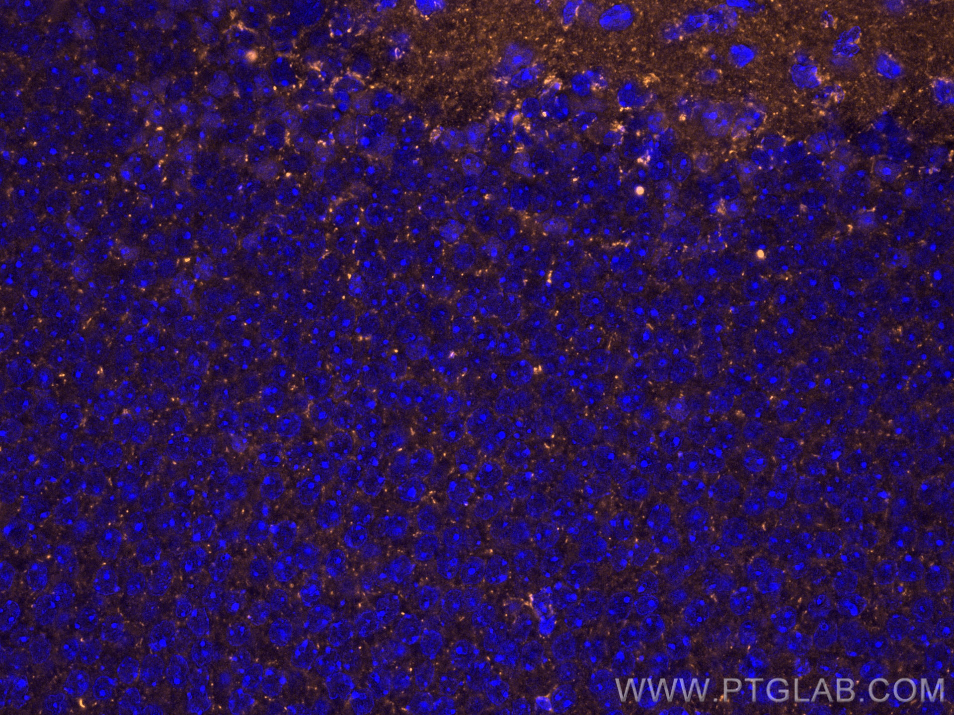 IF Staining of mouse brain using 18156-1-AP