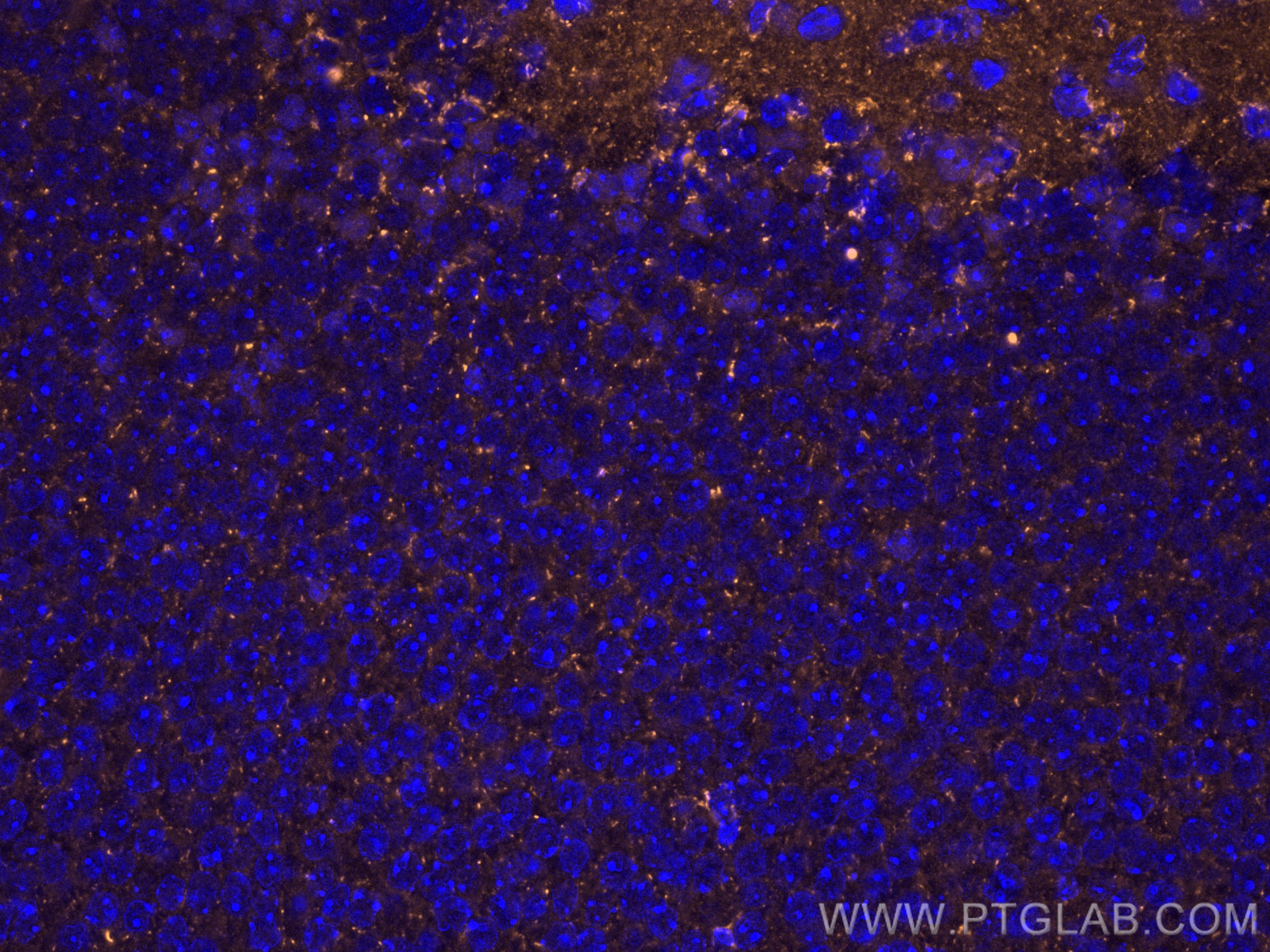 Immunofluorescence (IF) / fluorescent staining of mouse brain tissue using Piccolo Polyclonal antibody (18156-1-AP)