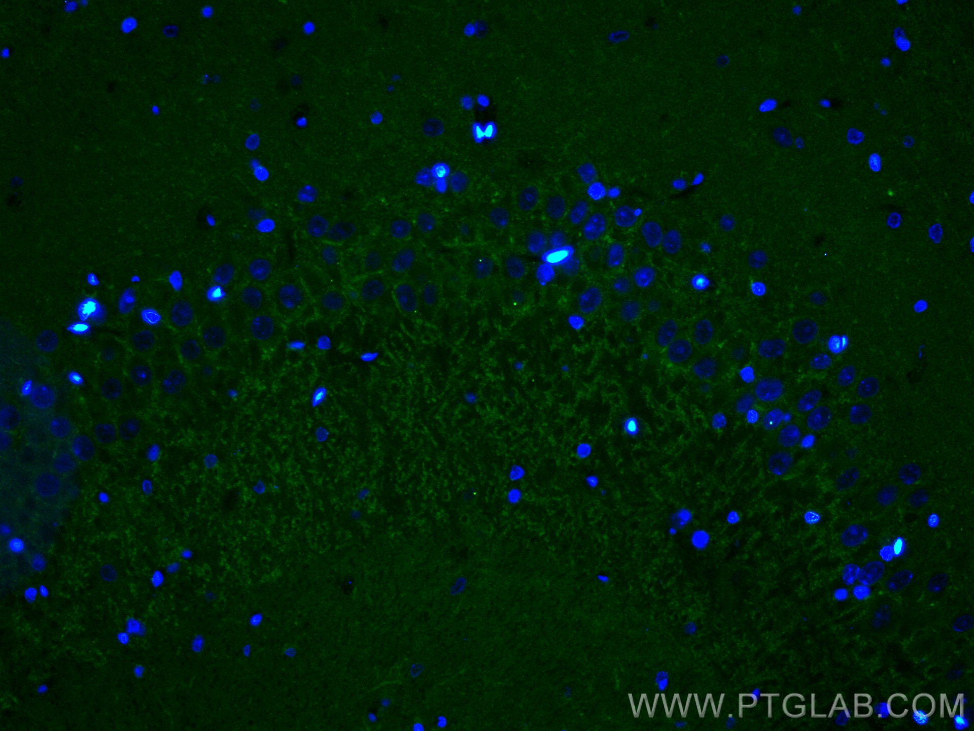 IF Staining of rat brain using 18156-1-AP (same clone as 18156-1-PBS) Immunofluorescence (IF) / fluorescent staining of rat brain tissue using Piccolo Polyclonal antibody (18156-1-AP)