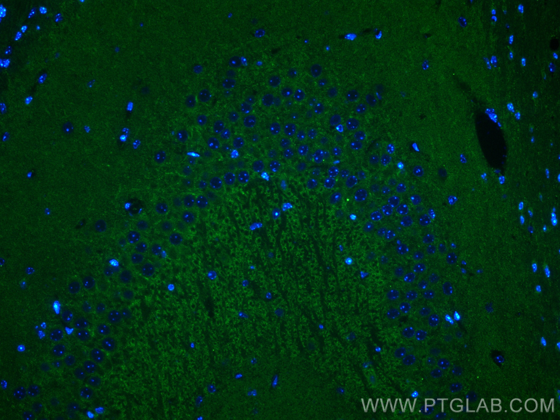 Immunofluorescence (IF) / fluorescent staining of mouse brain tissue using Piccolo Polyclonal antibody (18156-1-AP)