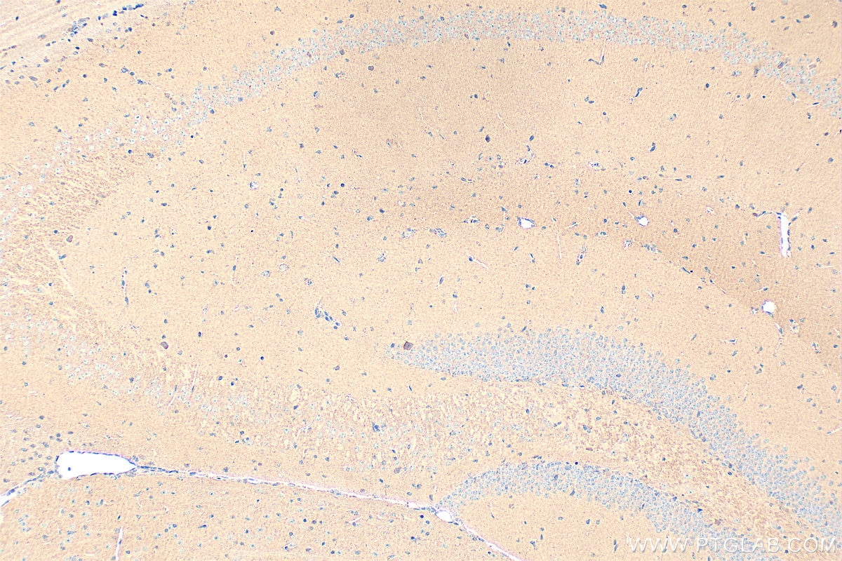 IHC staining of mouse brain using 18156-1-AP Immunohistochemistry (IHC) staining of mouse brain tissue using Piccolo Polyclonal antibody (18156-1-AP)