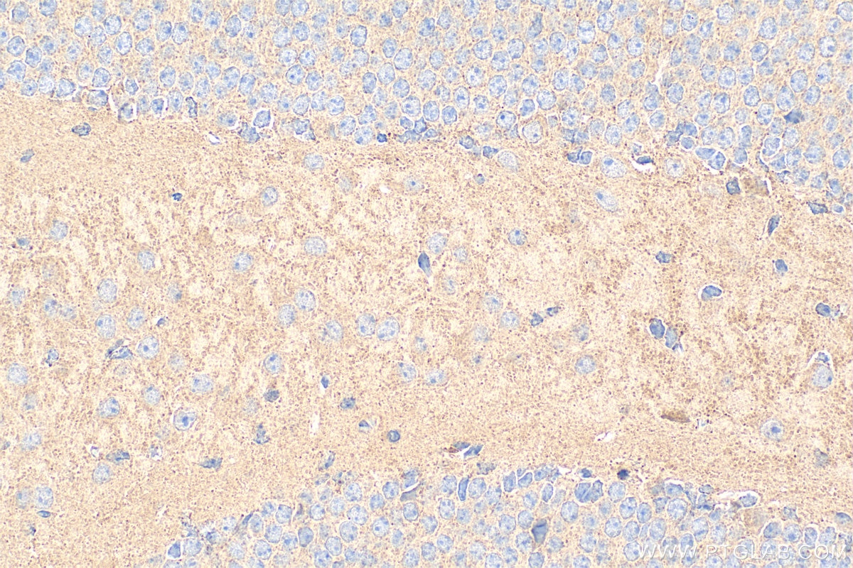 IHC staining of mouse brain using 18156-1-AP Immunohistochemistry (IHC) staining of mouse brain tissue using Piccolo Polyclonal antibody (18156-1-AP)