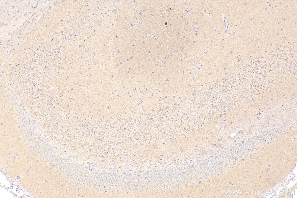 IHC staining of rat brain using 18156-1-AP Immunohistochemistry (IHC) staining of rat brain tissue using Piccolo Polyclonal antibody (18156-1-AP)