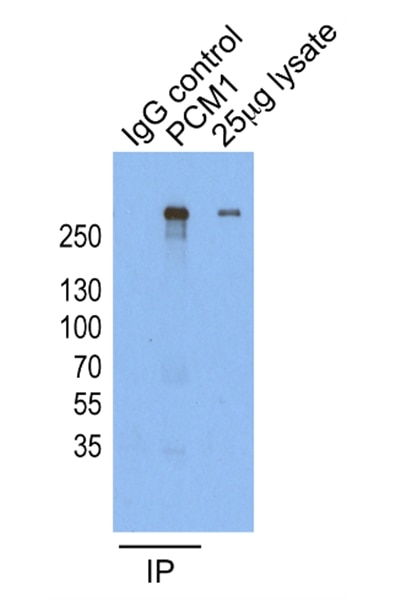 Immunoprecipitation (IP) experiment of HeLa cells using PCM1 Polyclonal antibody (19856-1-AP)