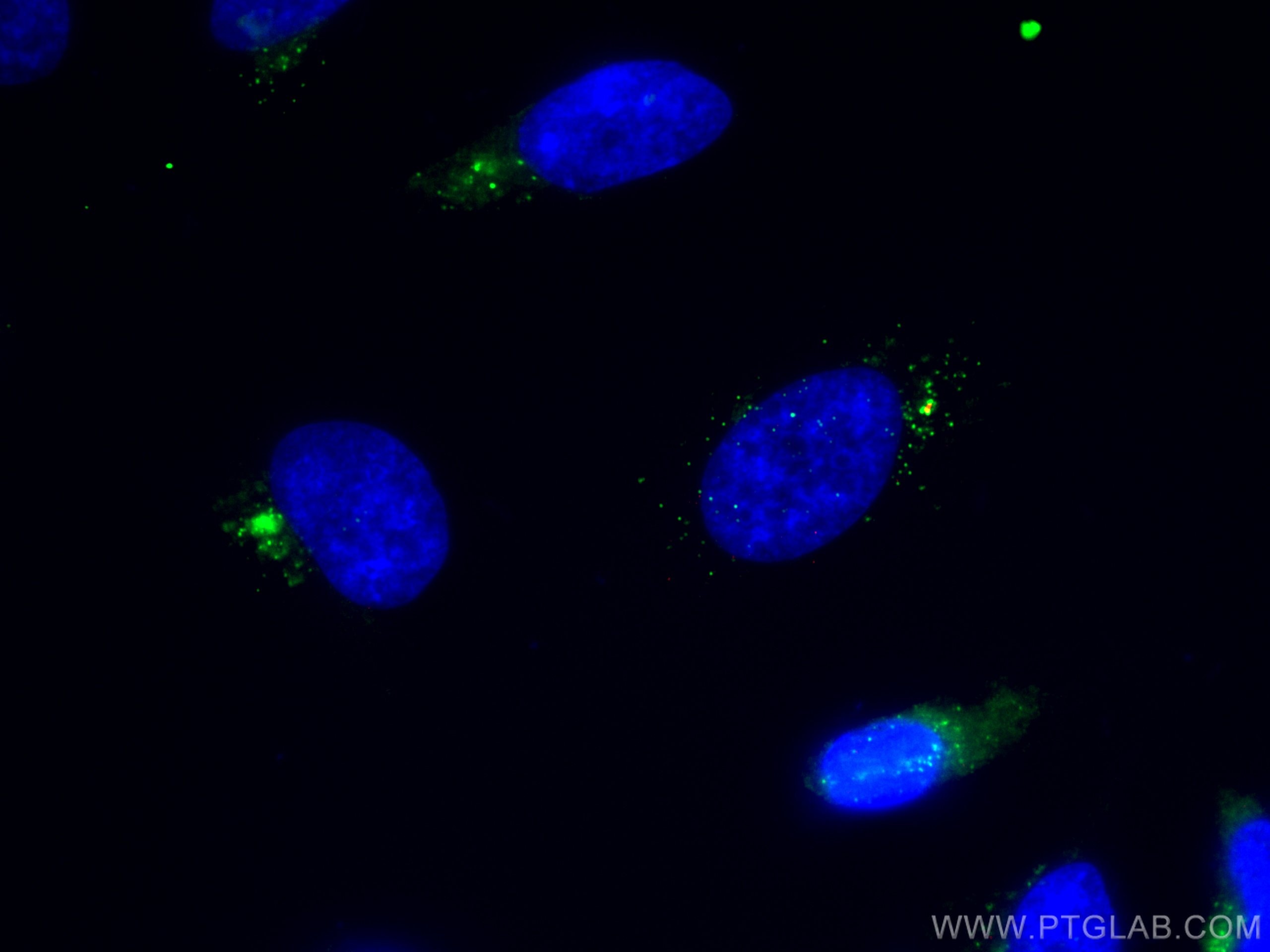 Immunofluorescence (IF) / fluorescent staining of HeLa cells using PCM1 Polyclonal antibody (19856-1-AP)