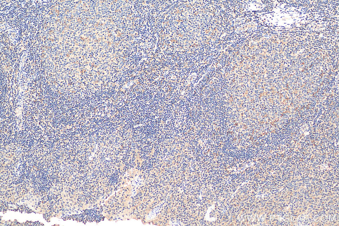 Immunohistochemistry (IHC) staining of human tonsillitis tissue using PCM1 Polyclonal antibody (19856-1-AP)