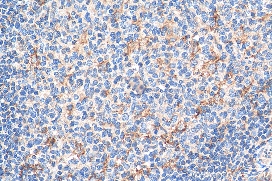 IHC staining of human tonsillitis using 19856-1-AP