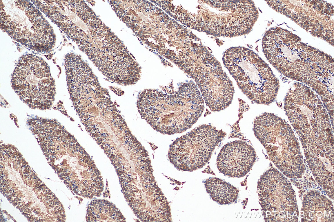 Immunohistochemistry (IHC) staining of mouse testis tissue using PCM1 Polyclonal antibody (19856-1-AP)