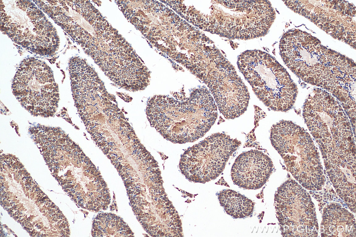 IHC staining of mouse testis using 19856-1-AP