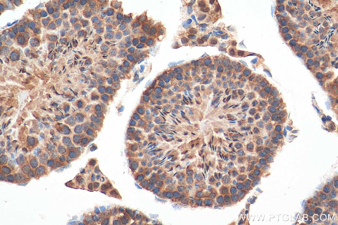 Immunohistochemistry (IHC) staining of mouse testis tissue using PCM1 Polyclonal antibody (19856-1-AP)