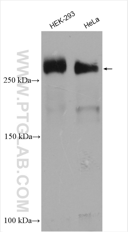 Western Blot (WB) analysis of various lysates using PCM1 Polyclonal antibody (19856-1-AP)