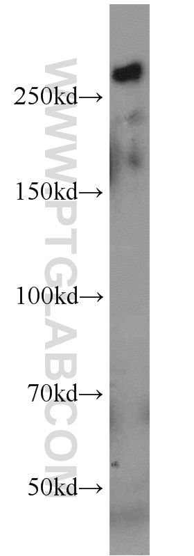 Western Blot (WB) analysis of NIH/3T3 cells using PCM1 Polyclonal antibody (19856-1-AP)