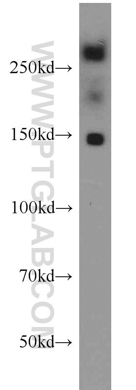 Western Blot (WB) analysis of HT-1080 cells using PCM1 Polyclonal antibody (19856-1-AP)