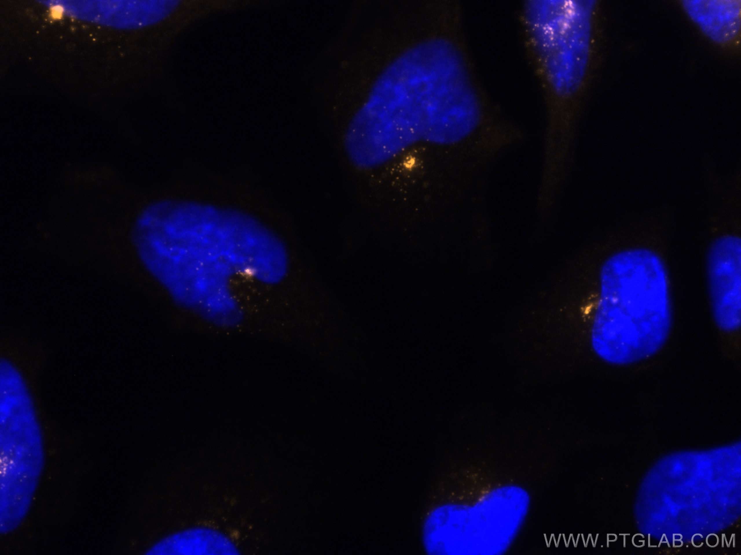 Immunofluorescence (IF) / fluorescent staining of HeLa cells using CoraLite®555-conjugated PCM1 Polyclonal antibody (CL555-19856)