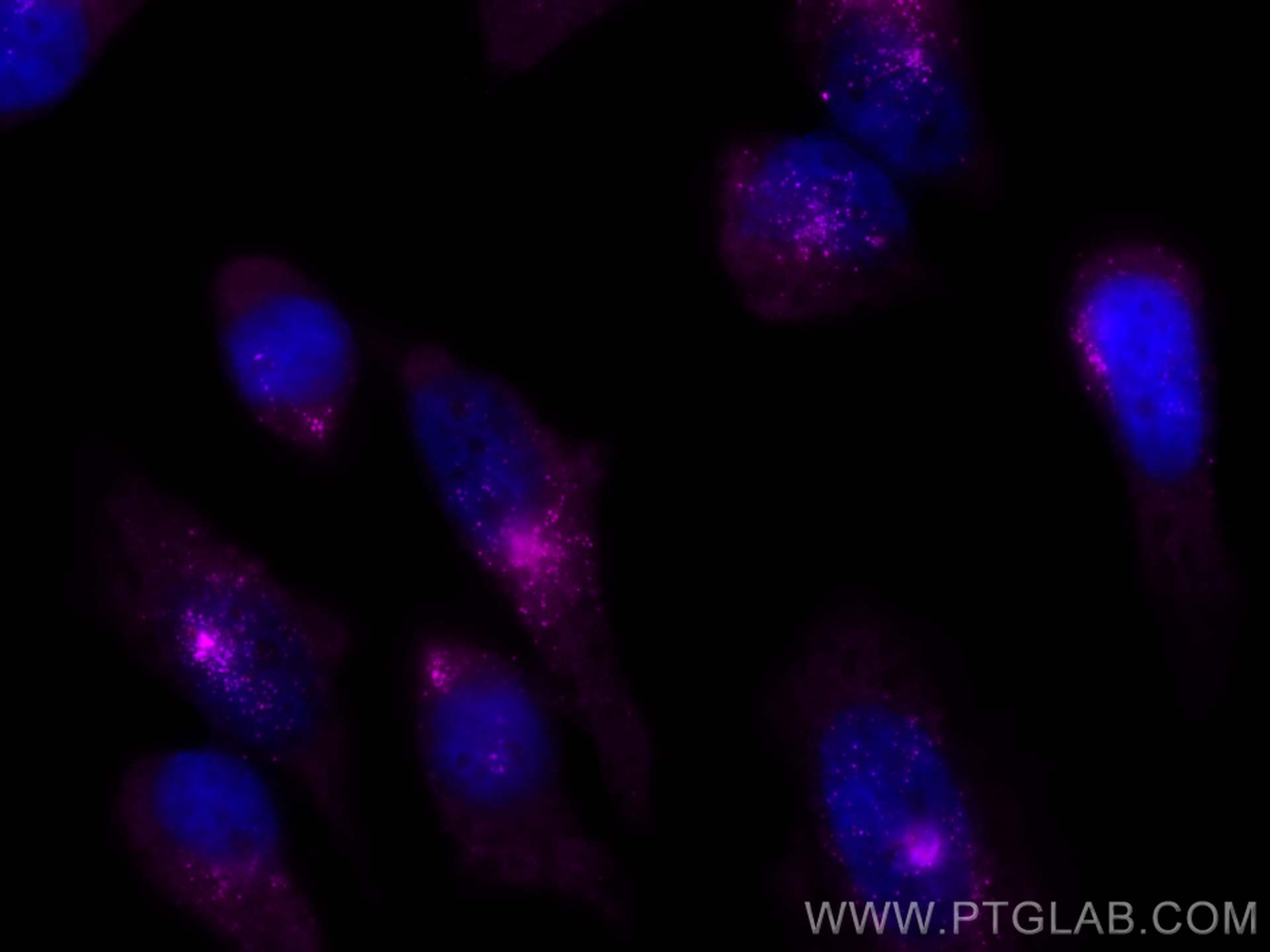 Immunofluorescence (IF) / fluorescent staining of HeLa cells using CoraLite® Plus 647-conjugated PCM1 Polyclonal anti (CL647-19856)