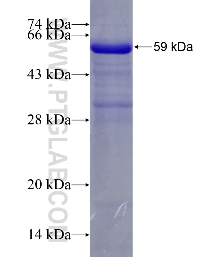 PCM1 fusion protein Ag13929 SDS-PAGE