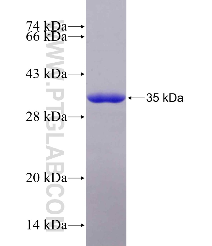 PCM1 fusion protein Ag13977 SDS-PAGE