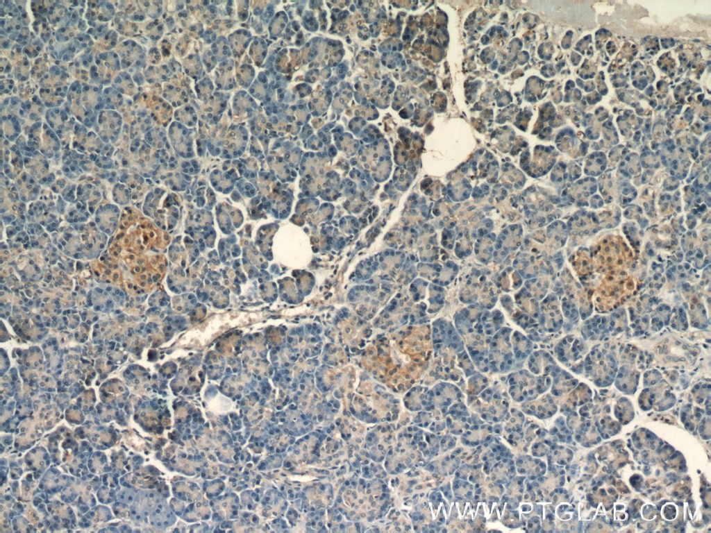 Immunohistochemistry (IHC) staining of human pancreas tissue using PCMT1 Polyclonal antibody (10519-1-AP)