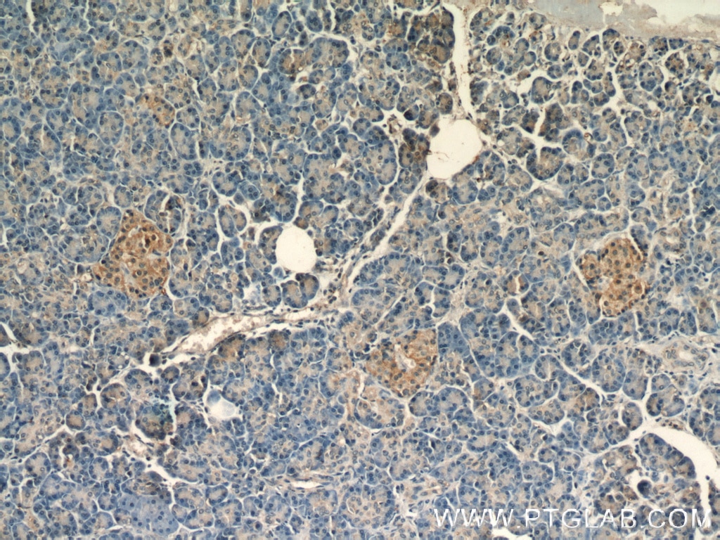 IHC staining of human pancreas using 10519-1-AP