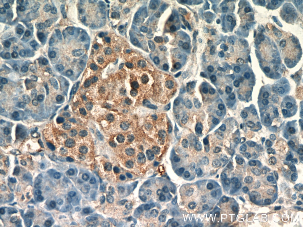 Immunohistochemistry (IHC) staining of human pancreas tissue using PCMT1 Polyclonal antibody (10519-1-AP)