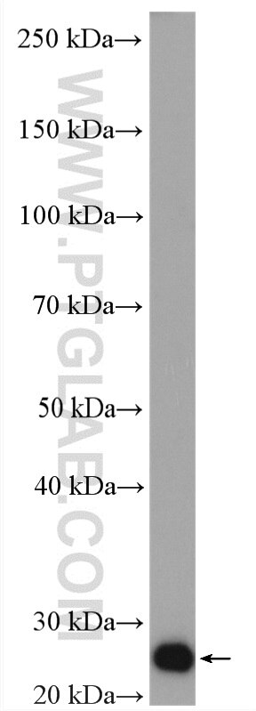 WB analysis of HeLa using 10519-1-AP